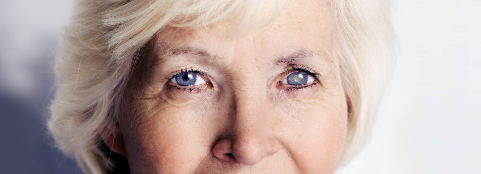 Cataract Surgery in Boerne